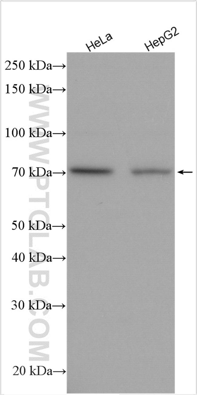 TNFAIP2 Antibody in Western Blot (WB)