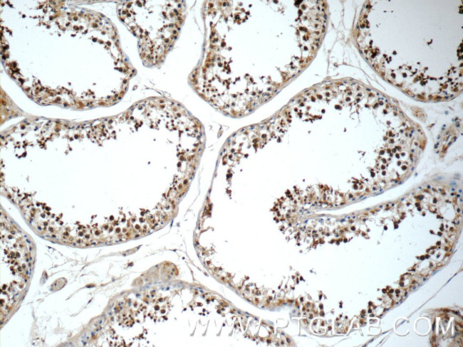 C19orf36 Antibody in Immunohistochemistry (Paraffin) (IHC (P))