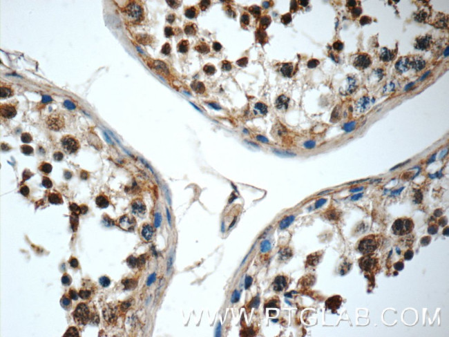 C19orf36 Antibody in Immunohistochemistry (Paraffin) (IHC (P))