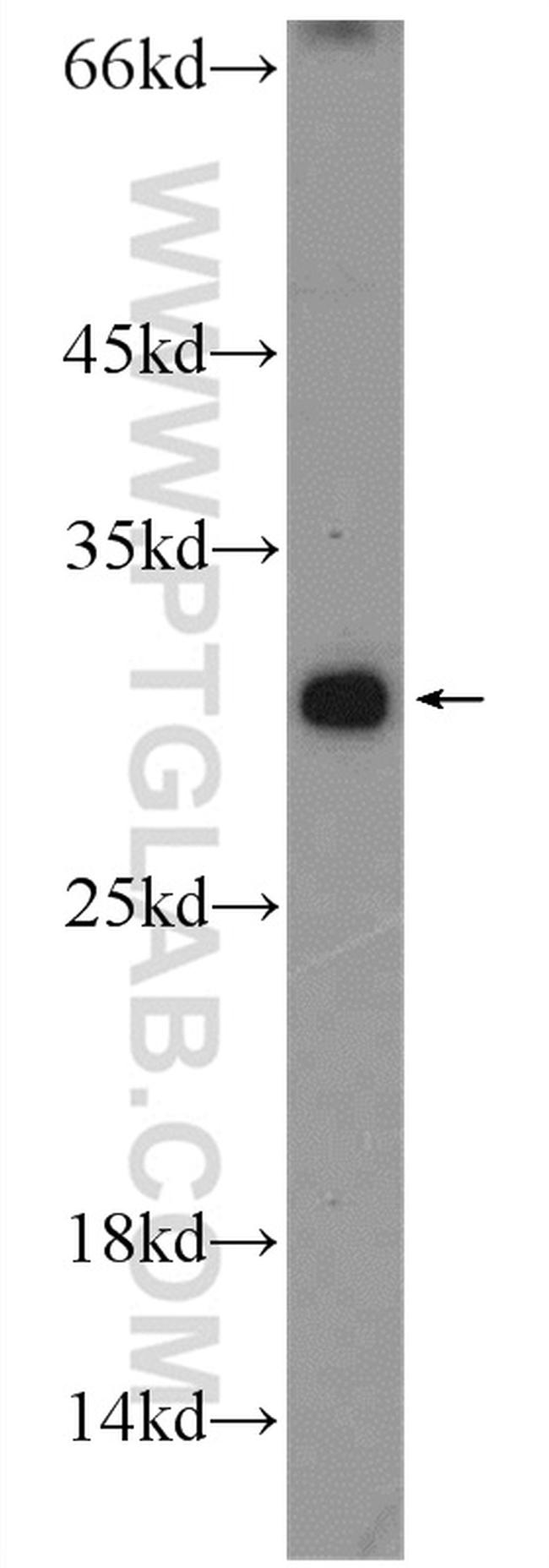 C19orf36 Antibody in Western Blot (WB)