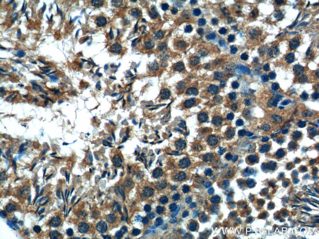 C19orf36 Antibody in Immunohistochemistry (Paraffin) (IHC (P))