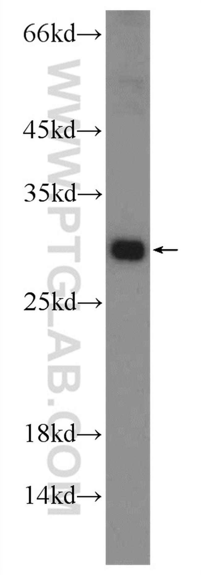 C19orf36 Antibody in Western Blot (WB)