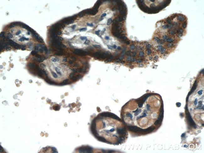 C11orf83 Antibody in Immunohistochemistry (Paraffin) (IHC (P))