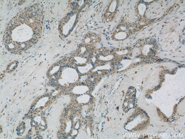 C11orf83 Antibody in Immunohistochemistry (Paraffin) (IHC (P))