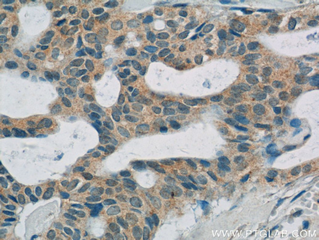 C11orf83 Antibody in Immunohistochemistry (Paraffin) (IHC (P))