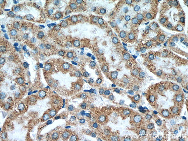 KIAA1279 Antibody in Immunohistochemistry (Paraffin) (IHC (P))