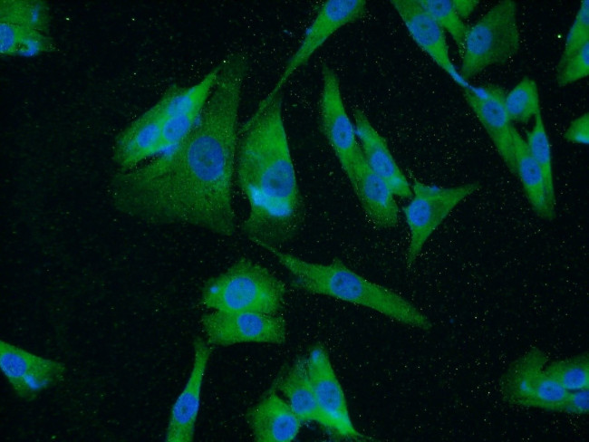 UACA Antibody in Immunocytochemistry (ICC/IF)