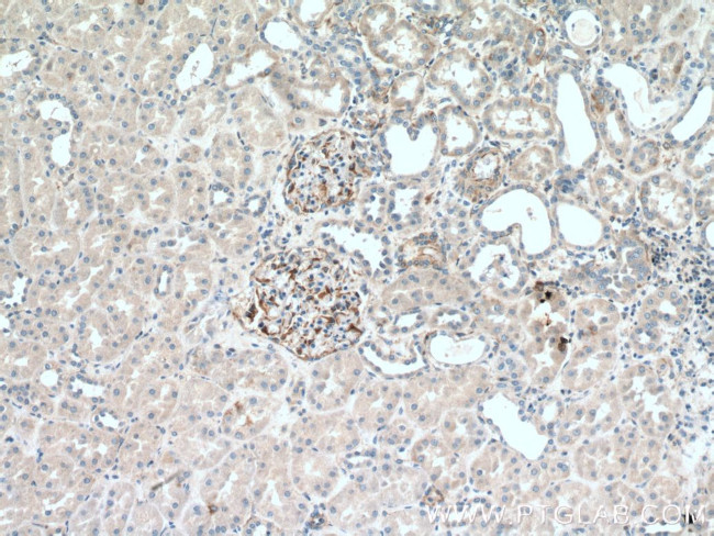 UACA Antibody in Immunohistochemistry (Paraffin) (IHC (P))