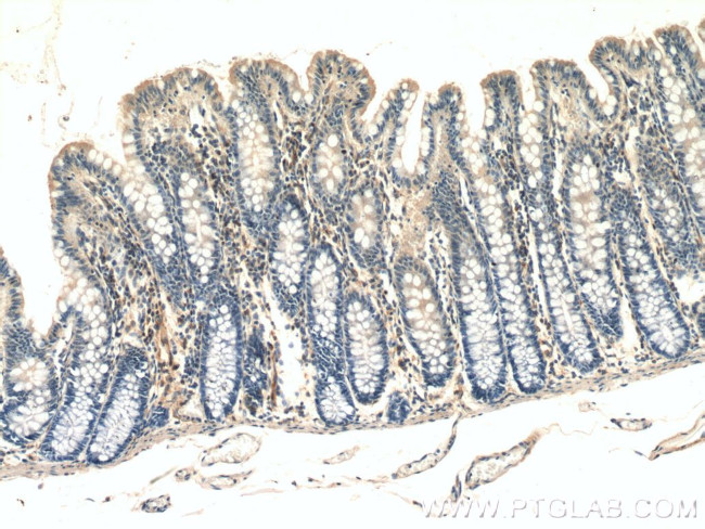 UACA Antibody in Immunohistochemistry (Paraffin) (IHC (P))