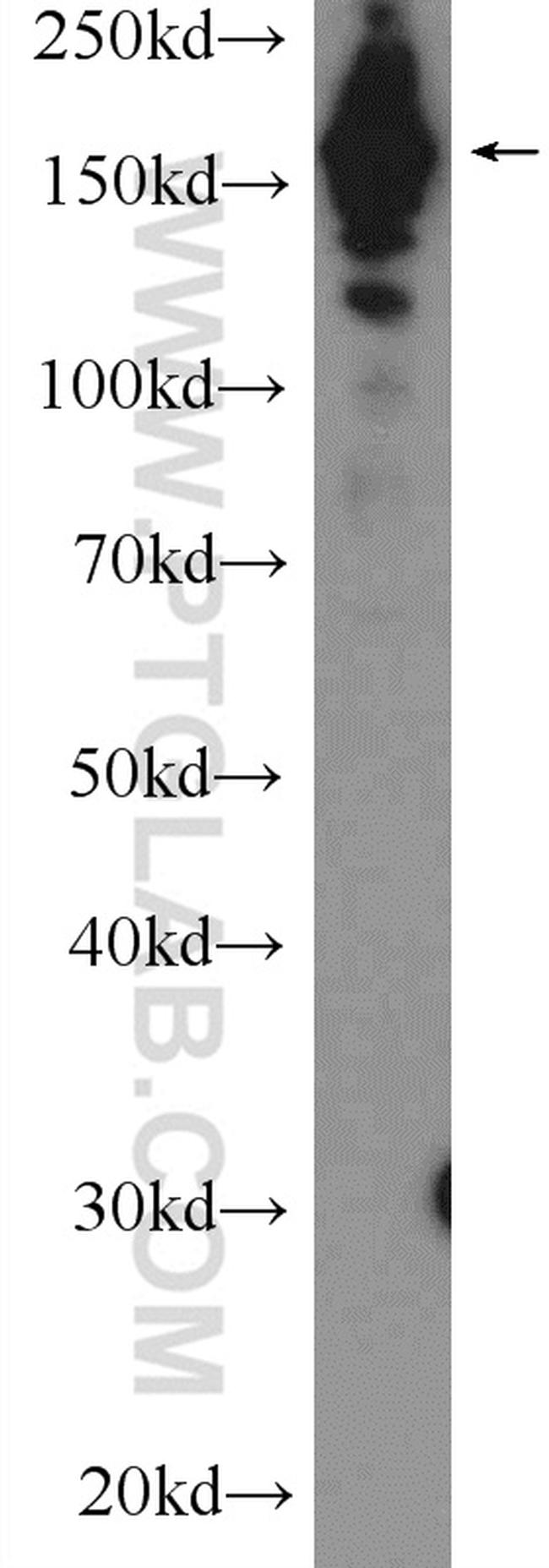 UACA Antibody in Western Blot (WB)