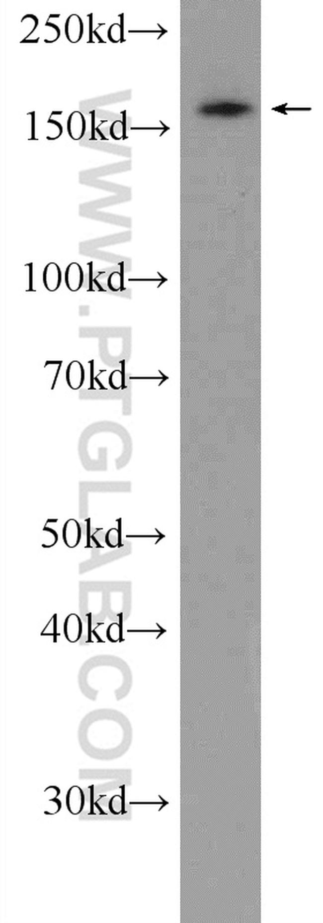 UACA Antibody in Western Blot (WB)