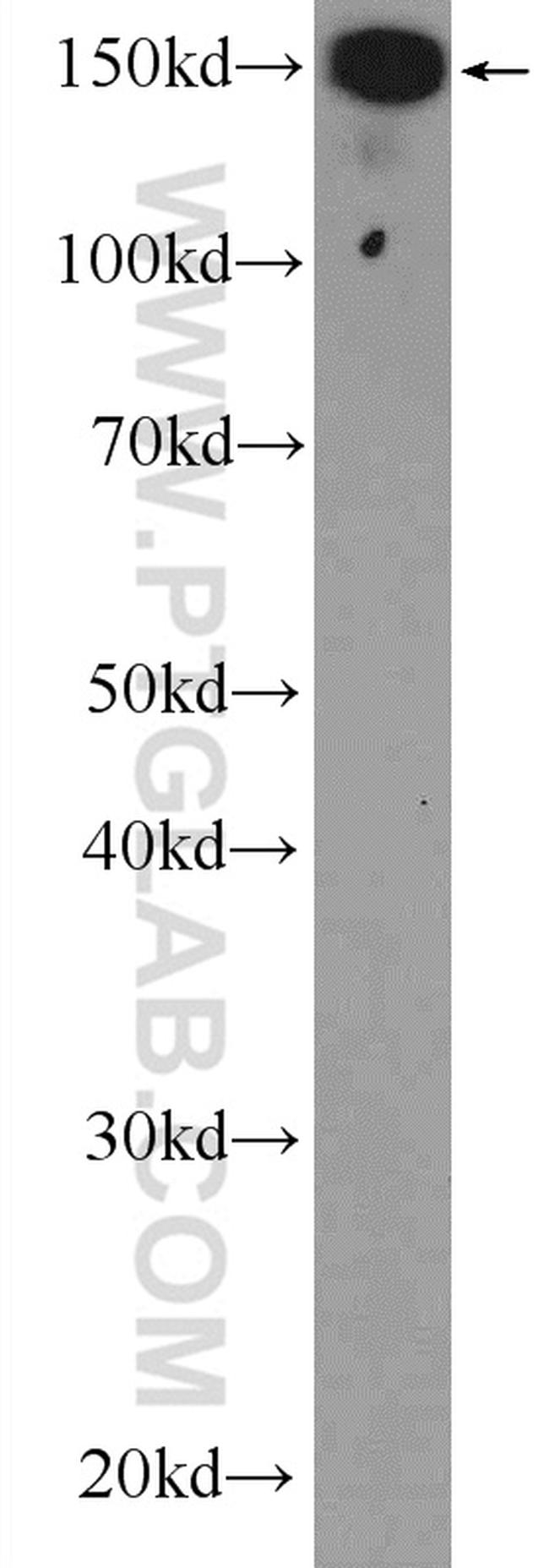 UACA Antibody in Western Blot (WB)