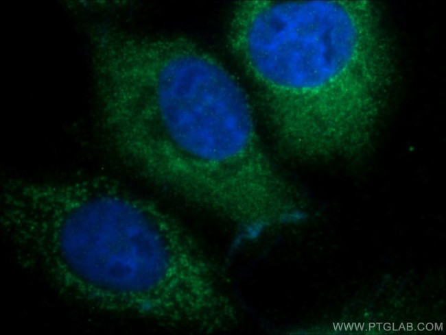 DENND1A Antibody in Immunocytochemistry (ICC/IF)