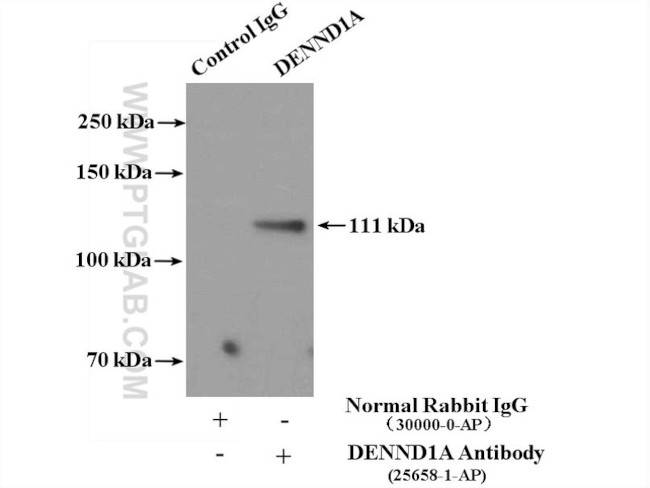DENND1A Antibody in Immunoprecipitation (IP)