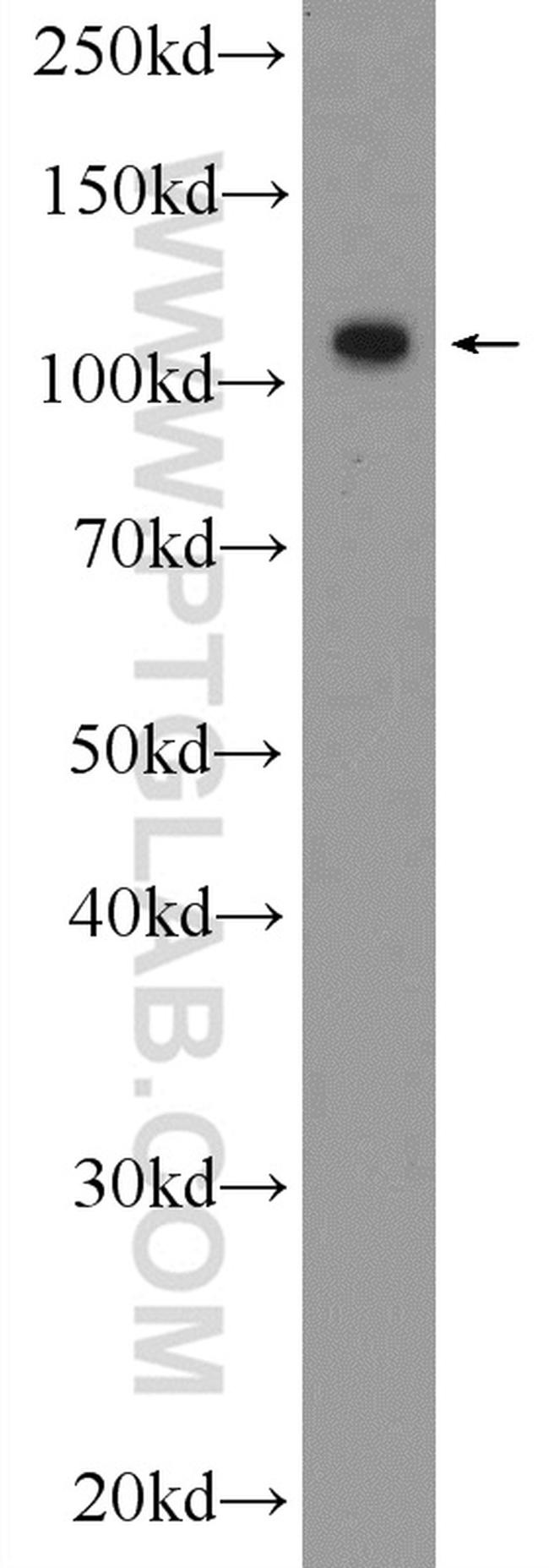 DENND1A Antibody in Western Blot (WB)