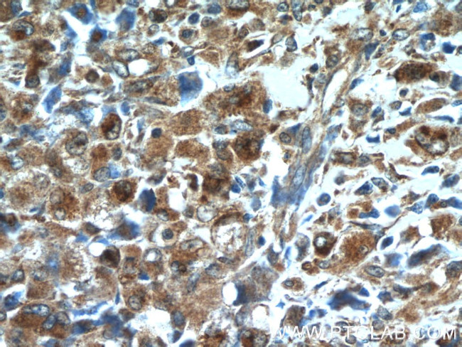 CD63 Antibody in Immunohistochemistry (Paraffin) (IHC (P))