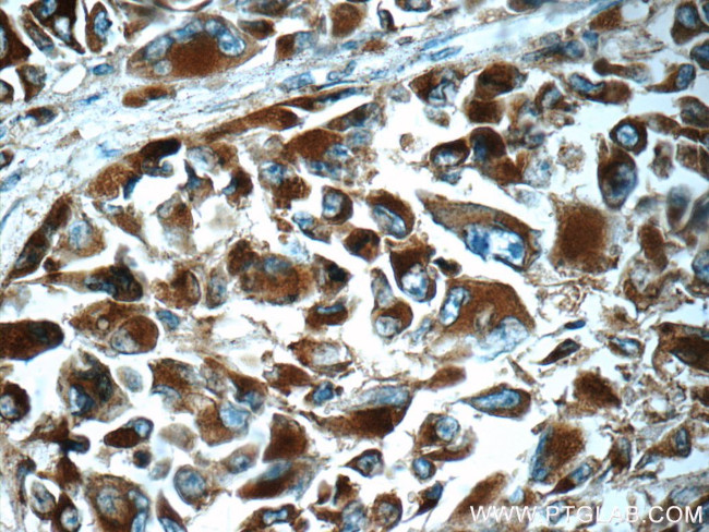 CD63 Antibody in Immunohistochemistry (Paraffin) (IHC (P))