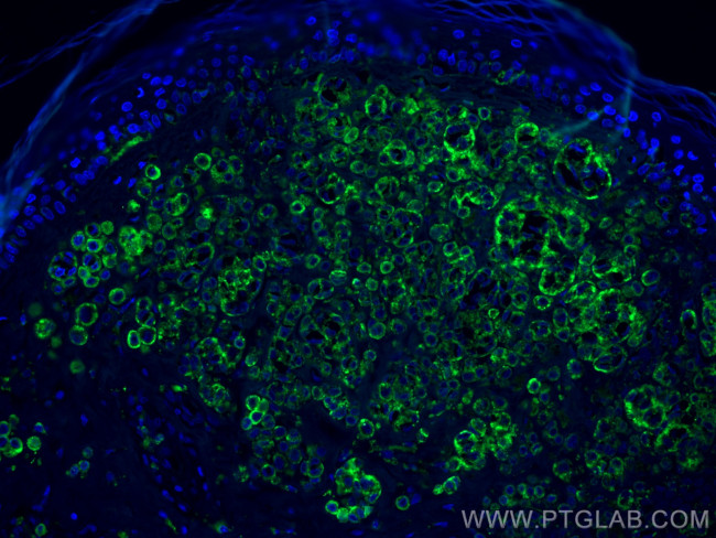 CD63 Antibody in Immunohistochemistry (PFA fixed) (IHC (PFA))