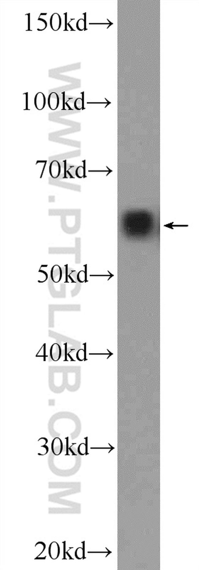 BAIAP2L1 Antibody in Western Blot (WB)