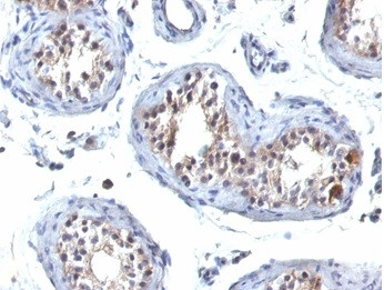 HGAL (Human Germinal Center Associated Lymphoma Marker) Antibody in Immunohistochemistry (Paraffin) (IHC (P))