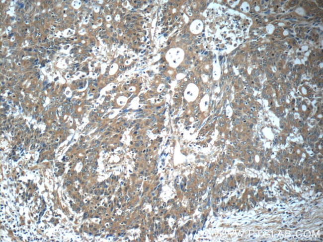 KIAA0841 Antibody in Immunohistochemistry (Paraffin) (IHC (P))