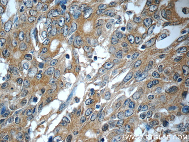 KIAA0841 Antibody in Immunohistochemistry (Paraffin) (IHC (P))