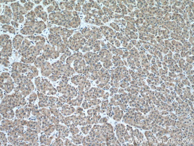 CARNS1 Antibody in Immunohistochemistry (Paraffin) (IHC (P))