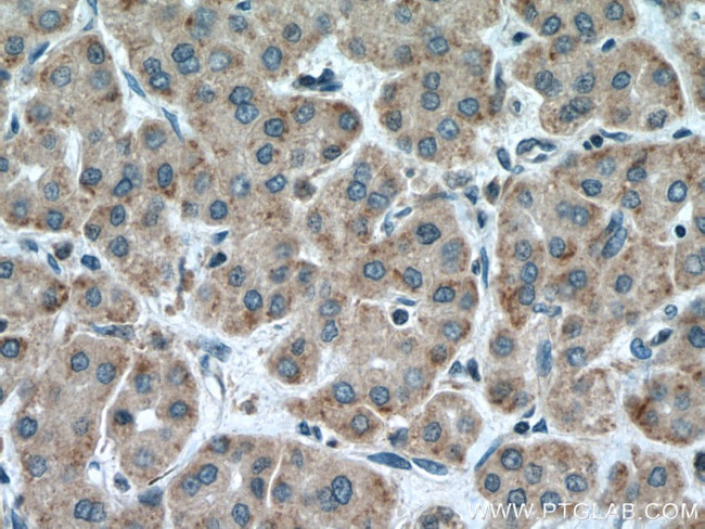 CARNS1 Antibody in Immunohistochemistry (Paraffin) (IHC (P))