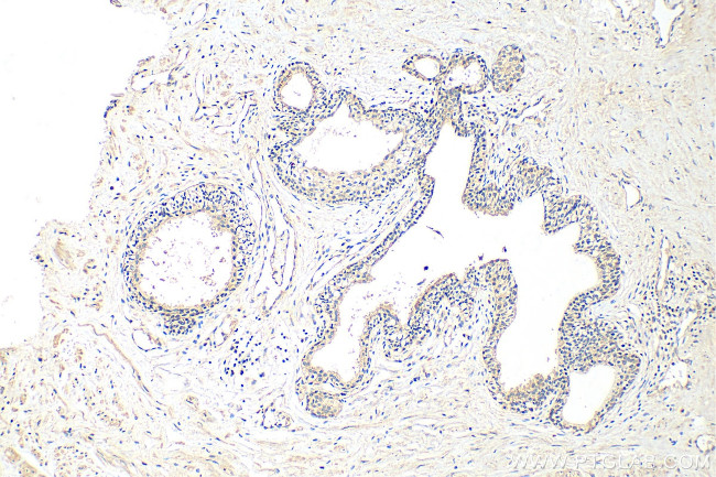 ATP1A3 Antibody in Immunohistochemistry (Paraffin) (IHC (P))