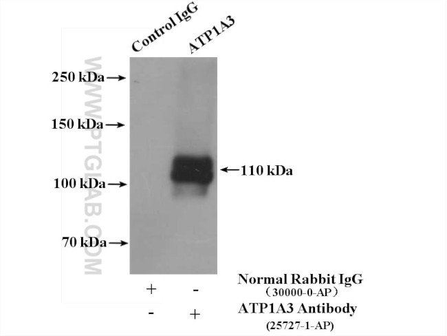 ATP1A3 Antibody in Immunoprecipitation (IP)