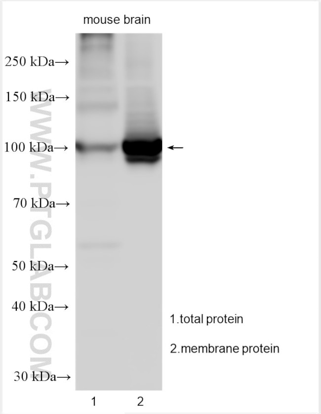 ATP1A3 Antibody in Western Blot (WB)