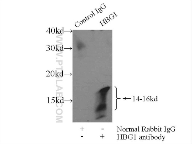 HBG1 Antibody in Immunoprecipitation (IP)