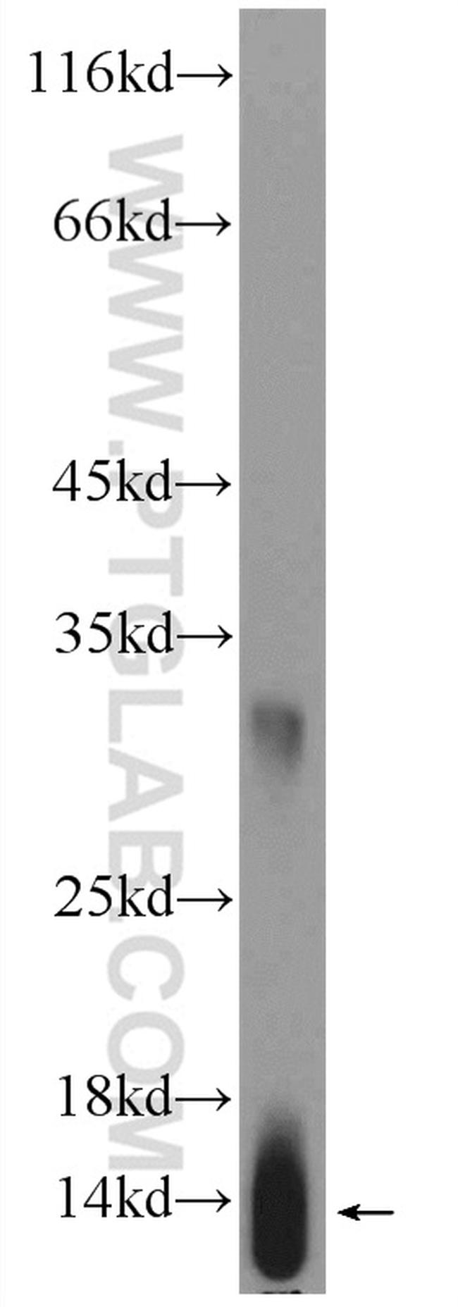 HBG1 Antibody in Western Blot (WB)