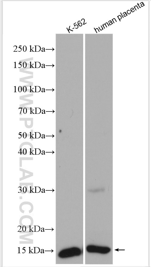 HBG1 Antibody in Western Blot (WB)