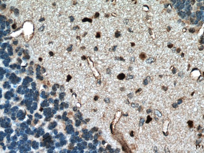 OLIG2 Antibody in Immunohistochemistry (Paraffin) (IHC (P))