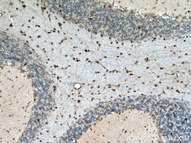 OLIG2 Antibody in Immunohistochemistry (Paraffin) (IHC (P))