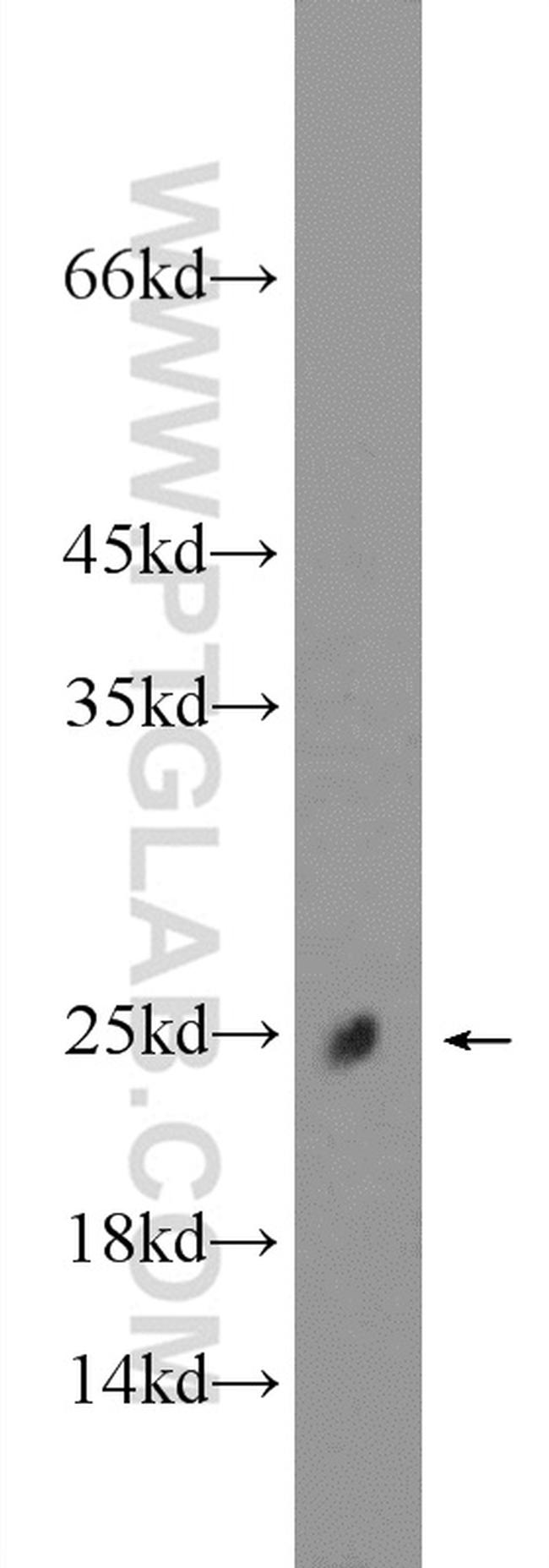 C11orf74 Antibody in Western Blot (WB)