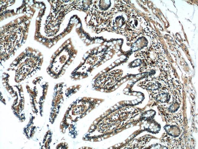 HNF4G Antibody in Immunohistochemistry (Paraffin) (IHC (P))