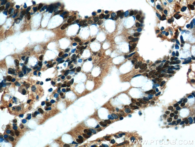 HNF4G Antibody in Immunohistochemistry (Paraffin) (IHC (P))