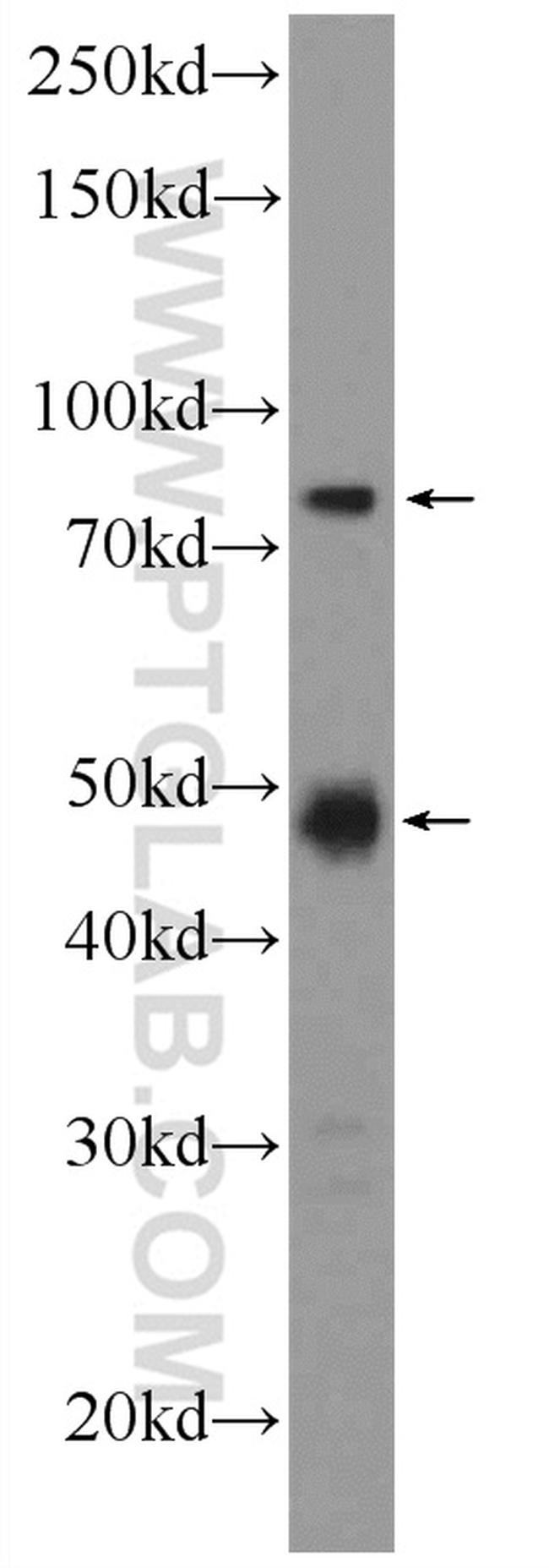 SETMAR Antibody in Western Blot (WB)