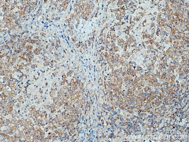 c-Cbl Antibody in Immunohistochemistry (Paraffin) (IHC (P))