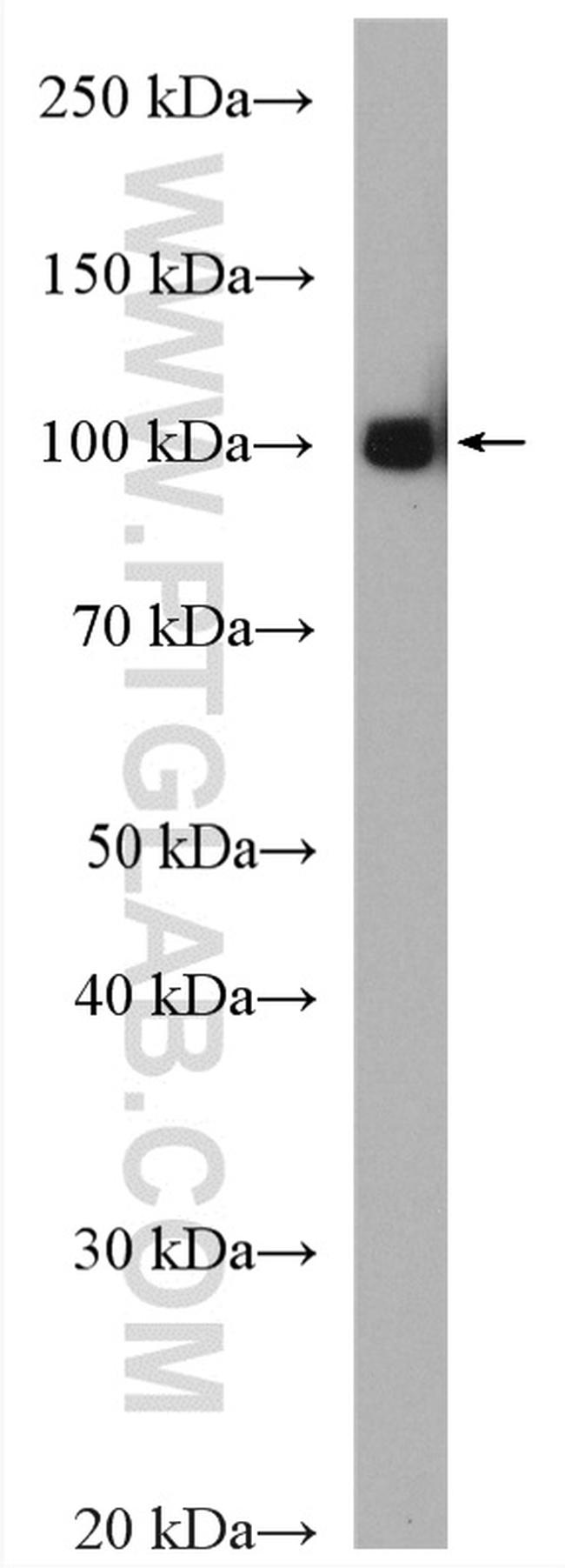 c-Cbl Antibody in Western Blot (WB)