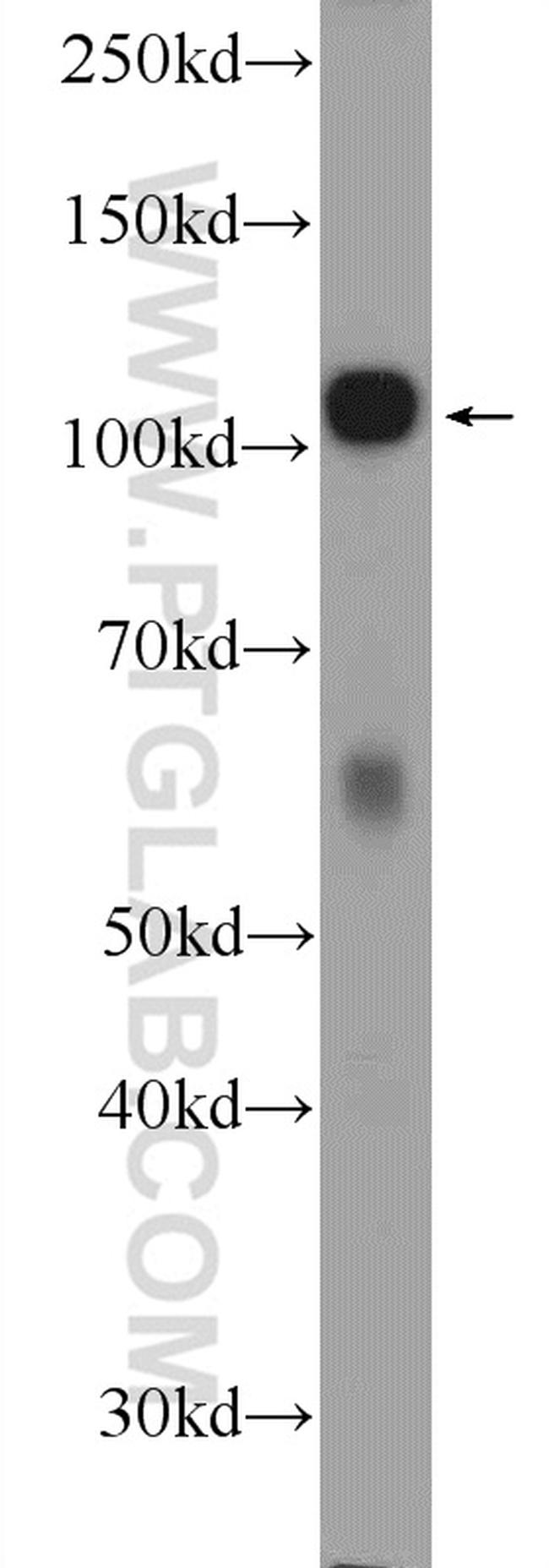 c-Cbl Antibody in Western Blot (WB)