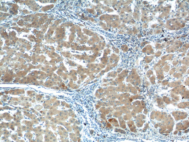 SMAD7 Antibody in Immunohistochemistry (Paraffin) (IHC (P))