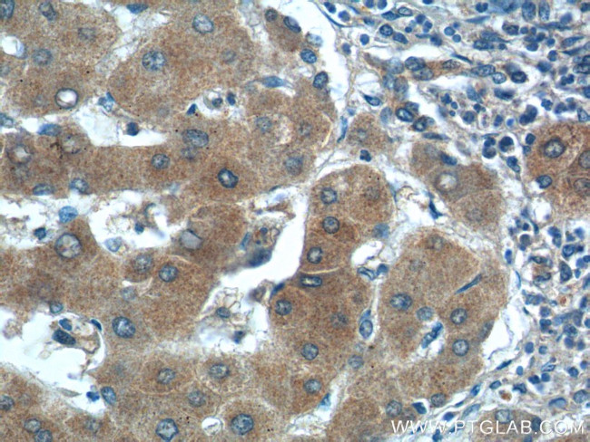 SMAD7 Antibody in Immunohistochemistry (Paraffin) (IHC (P))