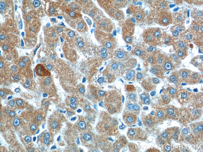 SMAD7 Antibody in Immunohistochemistry (Paraffin) (IHC (P))