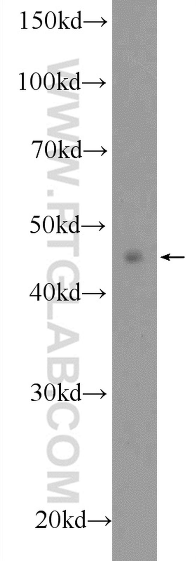 SMAD7 Antibody in Western Blot (WB)