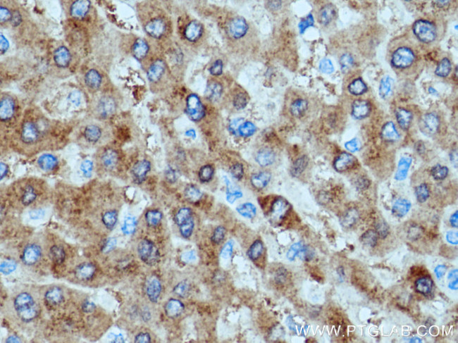 SAC3D1 Antibody in Immunohistochemistry (Paraffin) (IHC (P))