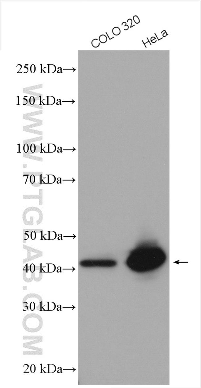SAC3D1 Antibody in Western Blot (WB)