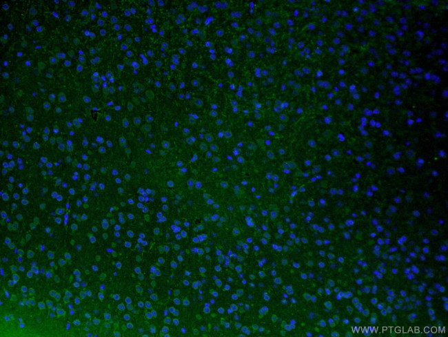 TH Antibody in Immunohistochemistry (PFA fixed) (IHC (PFA))